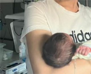 Miracoloso parto a Torino: 38enne partorisce dopo rimozione di un tumore cerebrale